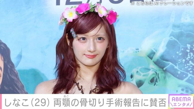 【写真・画像】しなこ、両顎の骨切り手術後のダウンタイム中の姿公開に「好感度がより高くなりました」「子どもにも影響力ある人が公表するのやめて欲しい」など様々な声　1枚目