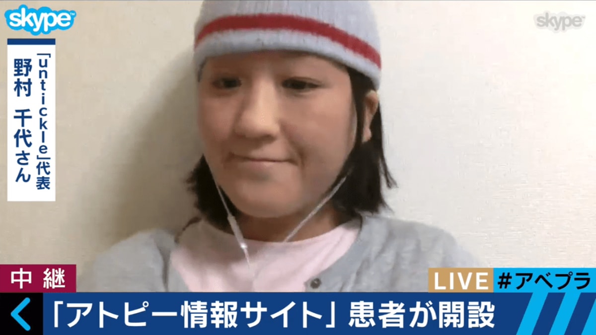 アトピー 性 皮膚 炎 芸能人