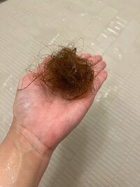 内山琴『産後抜け毛事情！！！』