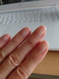 秋野暢子『抗がん剤の後遺症ですね。』