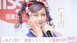 “両あごの骨切り手術を公表”しなこ（30）、激変ショットに「だ だれ!?」「SOPHIAの松岡さんかと思った」と絶賛の声