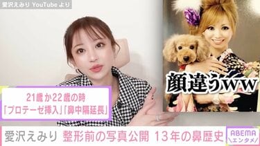 元キャバ嬢・愛沢えみり、13年に渡る鼻の整形と修正 整形前の写真も公開「お金もかかっています」 | エンタメ総合 | ABEMA TIMES |  アベマタイムズ