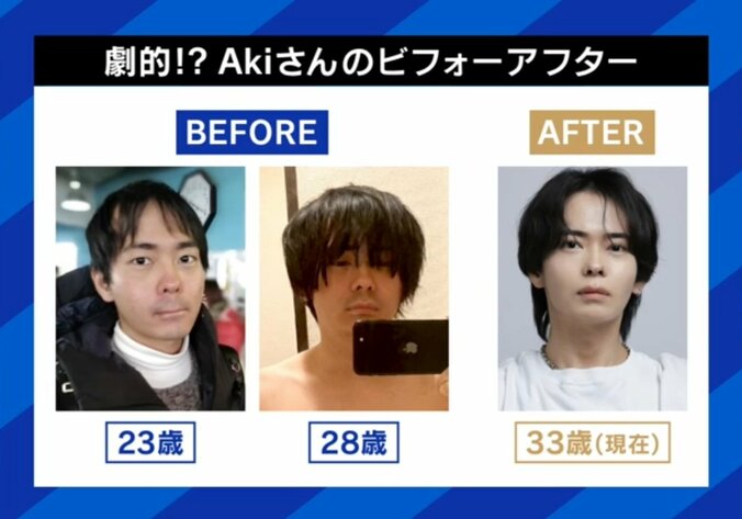 Akiさんのビフォーアフター