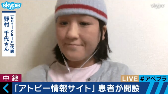 日本人の１割が患うアトピー性皮膚炎　“かゆみ”の治療に新たな道か 1枚目