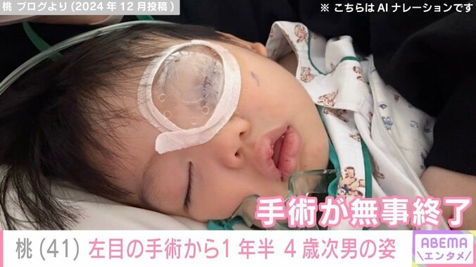 桃（41）、左目の先天性眼瞼下垂症の手術から1年半が経過した4歳次男の姿を公開 4枚目