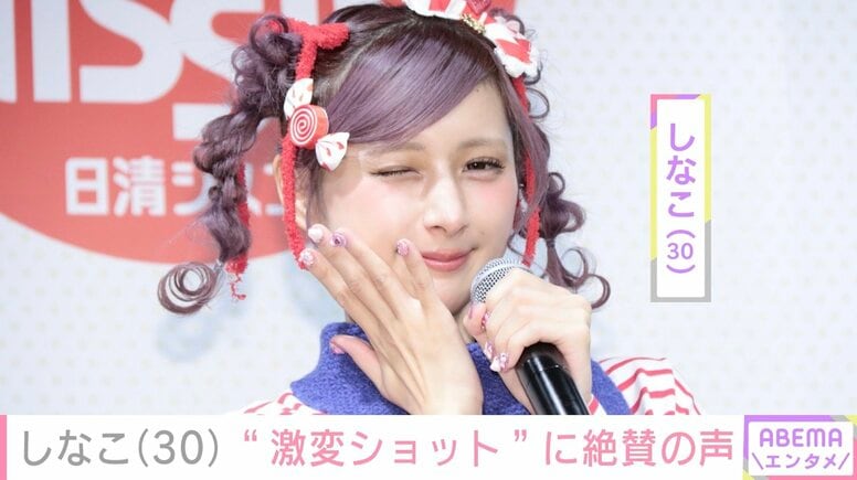 “両あごの骨切り手術を公表”しなこ（30）、激変ショットに「だ だれ!?」「SOPHIAの松岡さんかと思った」と絶賛の声