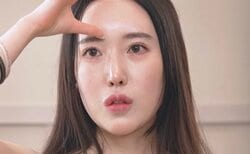 24歳整形美女、“3度の目の手術”とそのダウンタイムを語る「目をつむるたびに…」