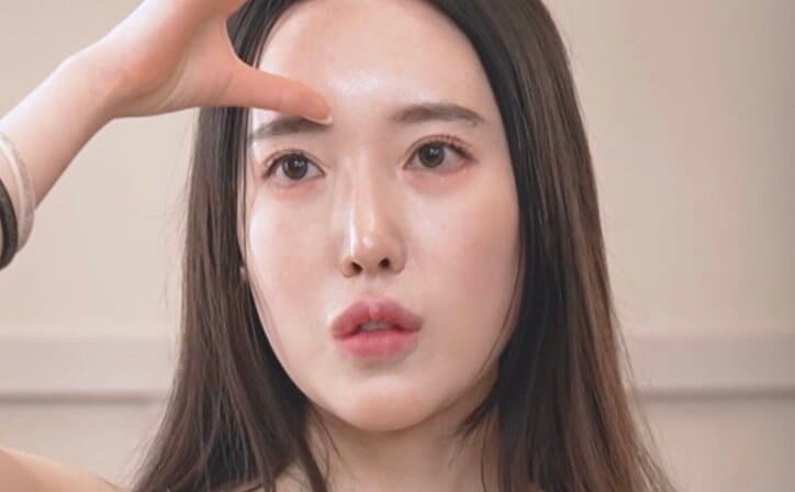 【写真・画像】24歳整形美女、“3度の目の手術”とそのダウンタイムを語る「目をつむるたびに痛かった」　1枚目