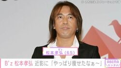 療養していたB'z 松本孝弘、近影に「やっぱり痩せたなぁ～」「大パニック」「やば～い」などの反響