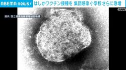 はしかワクチン接種を 集団感染小学校さらに急増