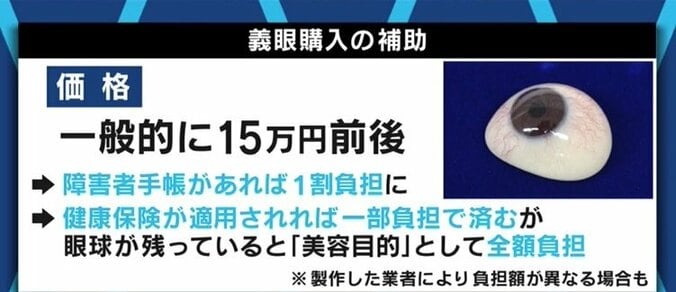 「義眼で人生が変わった」「片目が見えるじゃないかと言われ、障害者として認めてもらえない」…当事者たちに聞いた「片目失明」のリアル 15枚目