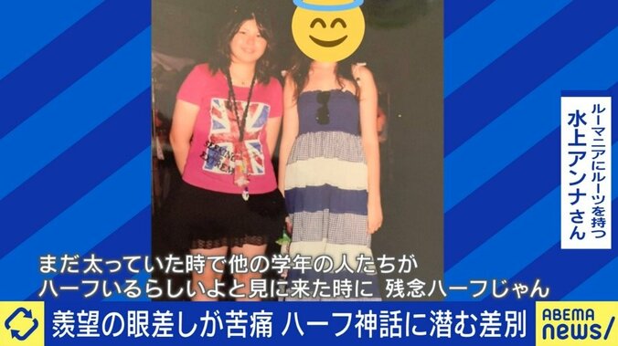 普通に接してほしいのに「当たりのハーフで良かったね」「残念ハーフじゃん」…日本社会の“ハーフ神話”に苦しんだ女性の訴え 4枚目