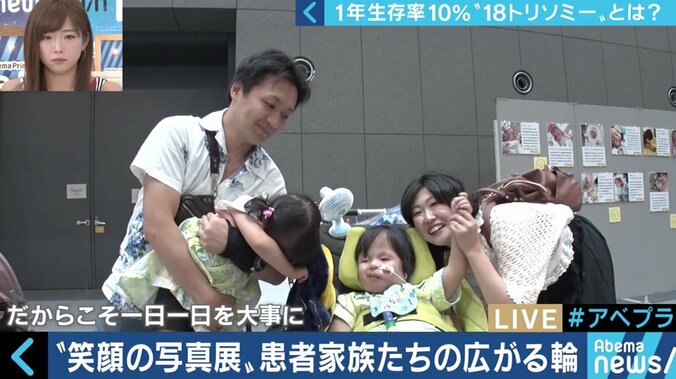“1年以上の生存率は10％”…18トリソミー児の家族たちが写真展に託した苦悩と葛藤 14枚目