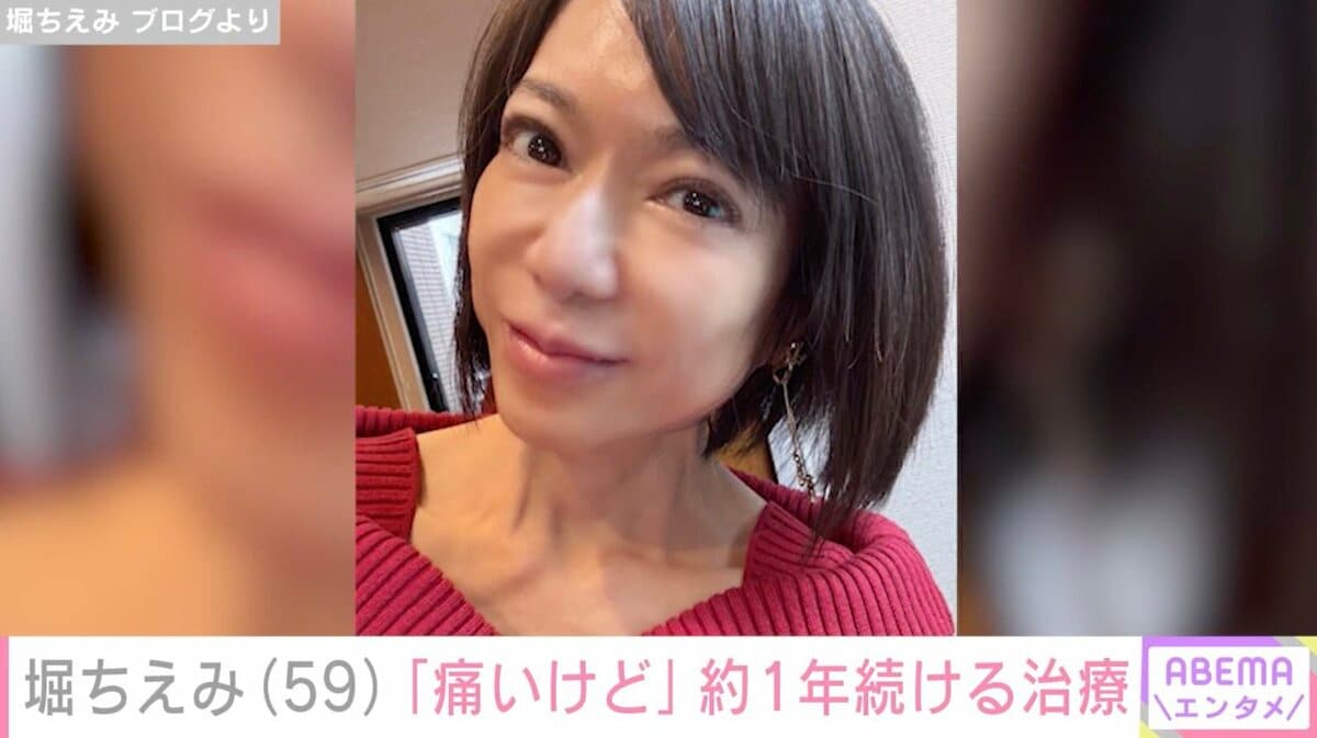 痛いけど」堀ちえみ（58）、約1年間受け続ける治療へ | エンタメ総合