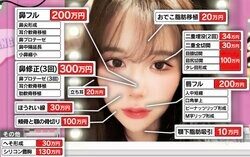 「1300万円で韓国女優顔に」整形美女が明かす執念の修正遍歴「1回目でアバター顔になって」「耳の軟骨が品切れ」