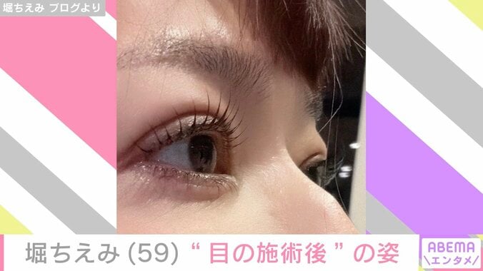 堀ちえみ（59）、“目の施術後”の自撮り写真を公開「とっても好みな仕上がり」 3枚目
