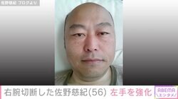 右腕切断した元プロ野球投手・佐野慈紀氏「なかなか慣れなくて…」左手を強化するアイテムを紹介