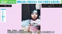 難聴の娘と手話を学ぶ母親 SNS発信による心境の変化