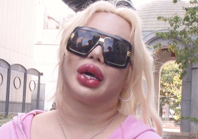 【写真・画像】整形総額1億円・アレン様、整形を始めた理由を告白　1枚目