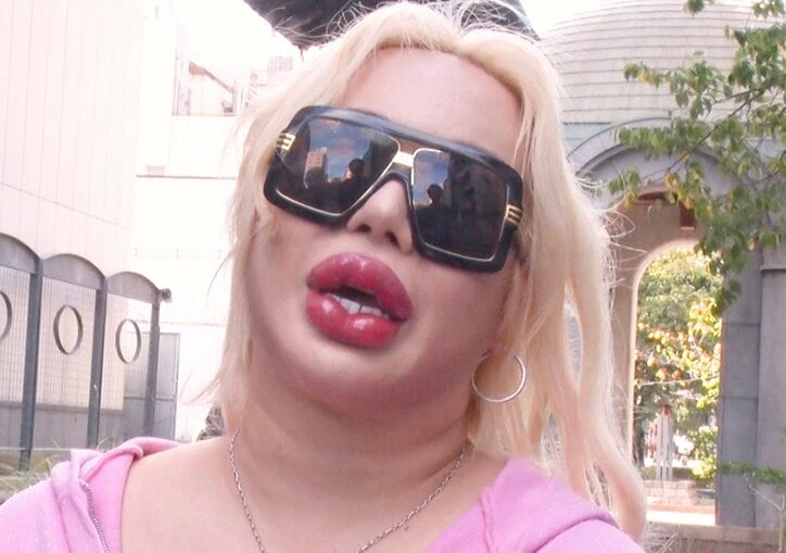 【写真・画像】整形総額1億円・アレン様、整形を始めた理由を告白　1枚目