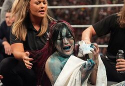 日本人女子レスラー、米マットで裏切りの“毒霧”被害 まさかの事態に錯乱