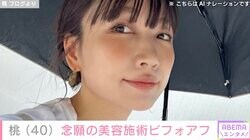 あいのり桃、念願の美容施術を受けビフォーアフター公開 過去には二重整形や糸リフトなど…