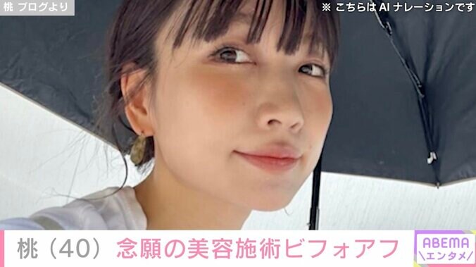 【写真・画像】あいのり桃、念願の美容施術を受けビフォーアフター公開 過去には二重整形や糸リフトなど…　1枚目