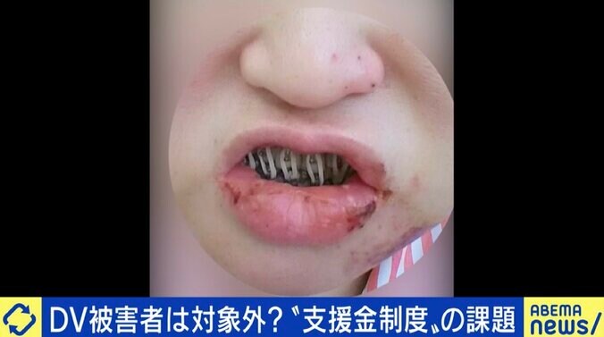 娘と息子を殺害されても680万円、殴られ後遺症が残っても0円…「犯罪被害給付制度」の不条理はナゼ起きる？ 8枚目