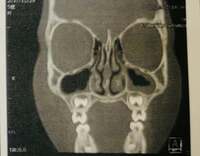 ココリコ遠藤嫁『結果は。。。』