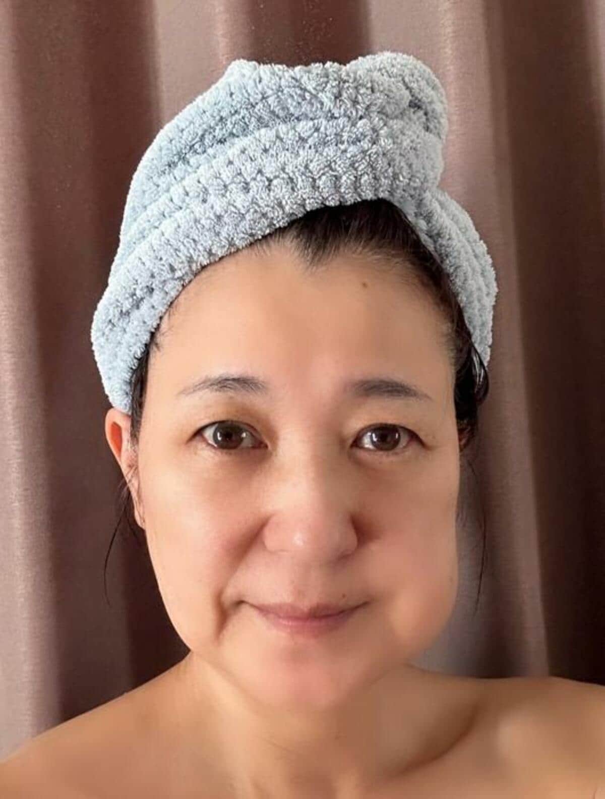 新田恵利、親知らずを抜いた後の自身の姿を公開「痛そう」「お大事に