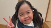 “手術控える”先天性疾患のりおなちゃん(7) の様子を母親がつづる