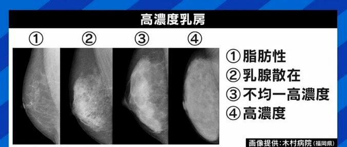 「セルフチェックに頼らず定期的な受診と、正しいルールの確立と運用を」乳がん検診の実情に専門医が指摘 7枚目