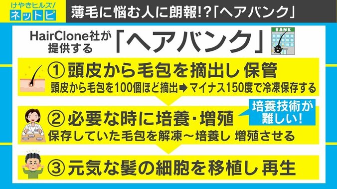 毛根を冷凍保存し将来の保険に、英でまもなく運用「ヘアバンク」の実用性は 2枚目