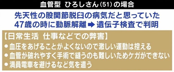 「何もできないと決めつけないで」エーラス・ダンロス症候群とは？ 当事者が明かす症状 1枚目