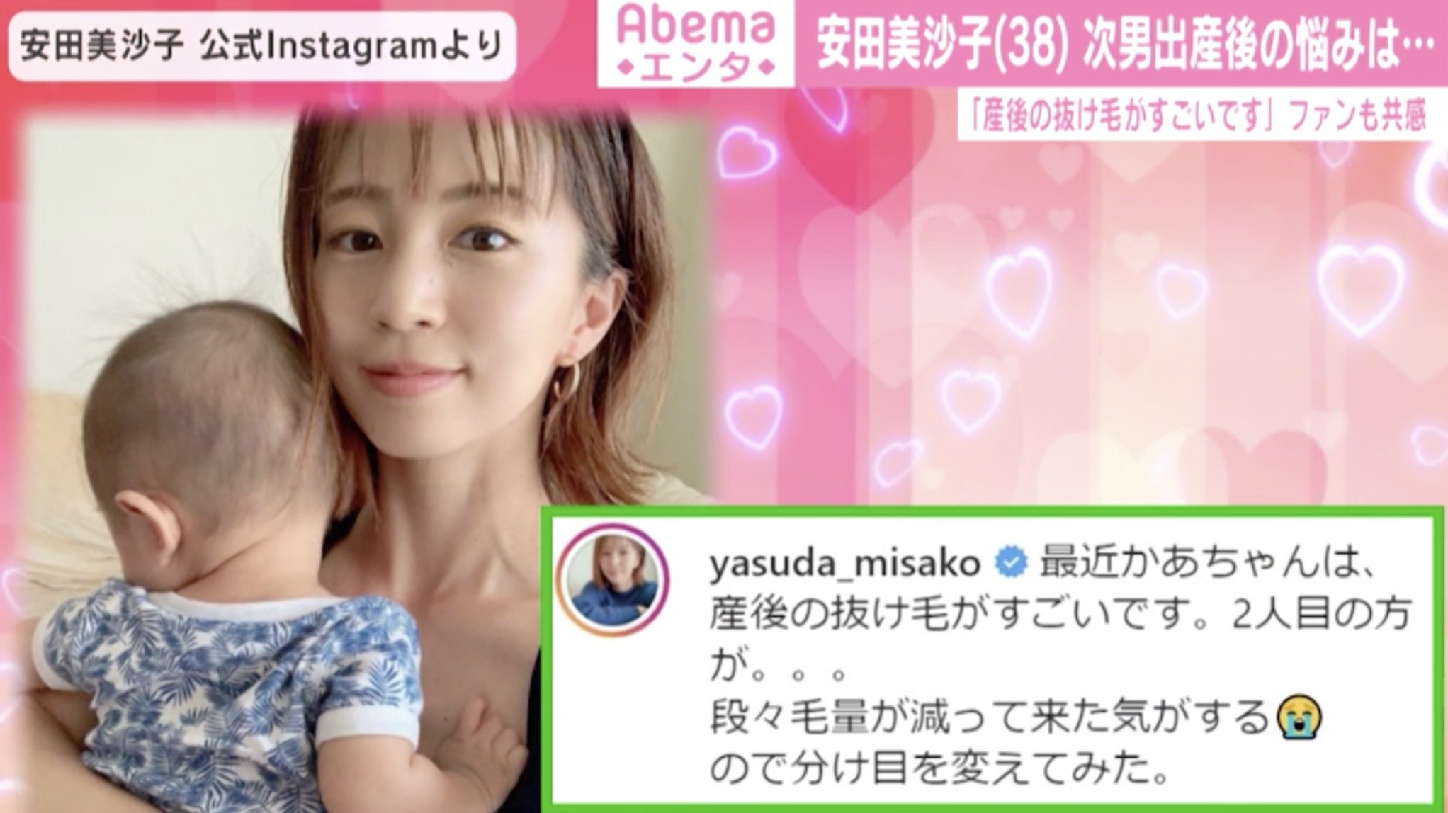 安田美沙子 第2子出産後の悩み 抜け毛がすごいです ファンからは共感の声 芸能 Abema Times 安田美沙子 第2子出産後の悩み 抜け毛がすごいです ファンからは共感の声 芸能 Abema Times