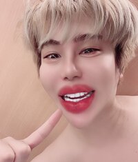 アレン『実は数日前から、入れ替えた前歯が……。』