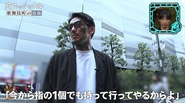 BreakingDown”瓜田純士、自分で小指を食いちぎった過去を告白「途中で指がぶら下がってしまった」 | バラエティ | ABEMA TIMES  | アベマタイムズ