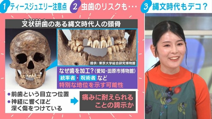 ティースジュエリー