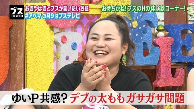 ゆいP、恋愛に一歩踏み出せない理由を語る「太ももの付け根が真っ黒で…」 1枚目