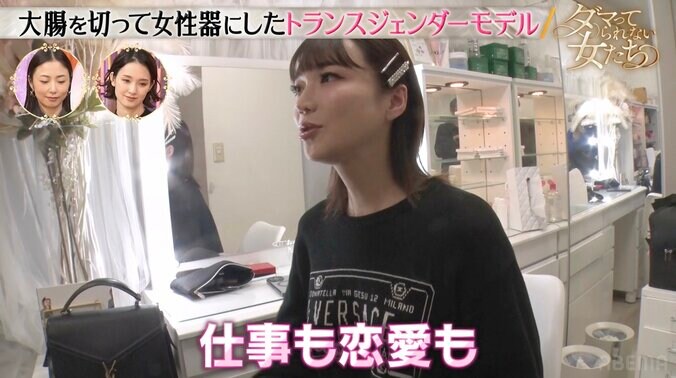 【写真・画像】総額2000万円！全身フル整形のトランスジェンダーモデル、18歳から美容整形を続ける理由を告白　2枚目