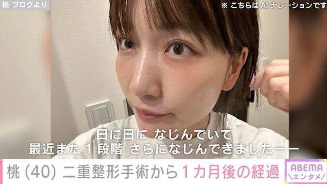 【写真・画像】3度目の二重整形をした桃(40) 手術から1カ月後の経過を公開「目が元気になった！やってよかった」　1枚目