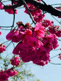 だいたひかる、血栓の可能性があり検査「手術するかしないか」 - Ameba News [アメーバニュース]