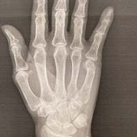 小柳ルミ子『昨日の治療に感動』