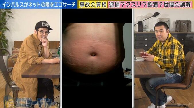 インパルス堤下、事故内容について弁明「人を轢いたと誤解されている」 4枚目