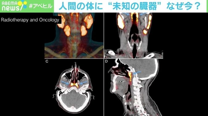 人間の体に“未知の臓器”発見、なぜ今？ 研究チームの医師を直撃 臓器の“定義”によって今後新たに見つかる可能性も？ 4枚目