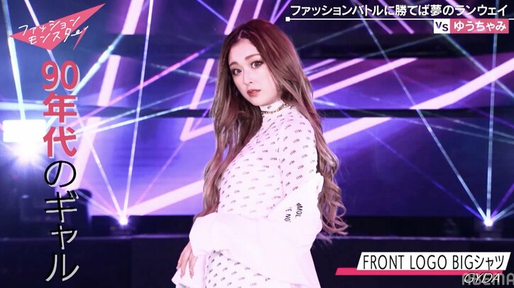 “スパイラル骨折”のゆうちゃみ 美脚に包帯を巻いた姿に絶賛の声「流行りそう」「包帯さえもおしゃれに見える」