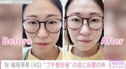 エヴァ芸人・桜 稲垣早希（40）、移住先のタイで“プチ整形” 施術後の姿に「可愛すぎて3度見した」の声
