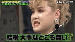 ぺえ、自粛期間中に20kg増で前歯を失う…「もういいかなって」病みモードに心配の声