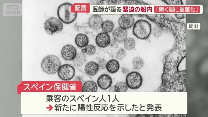 スペイン人1人に陽性反応