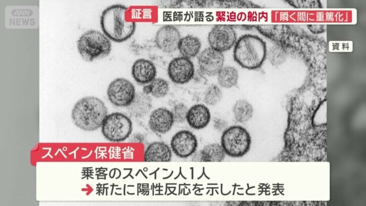 スペイン人1人に陽性反応